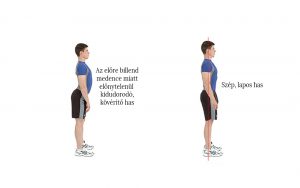 ágyéki nagy lordózis